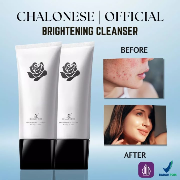 Chalonese